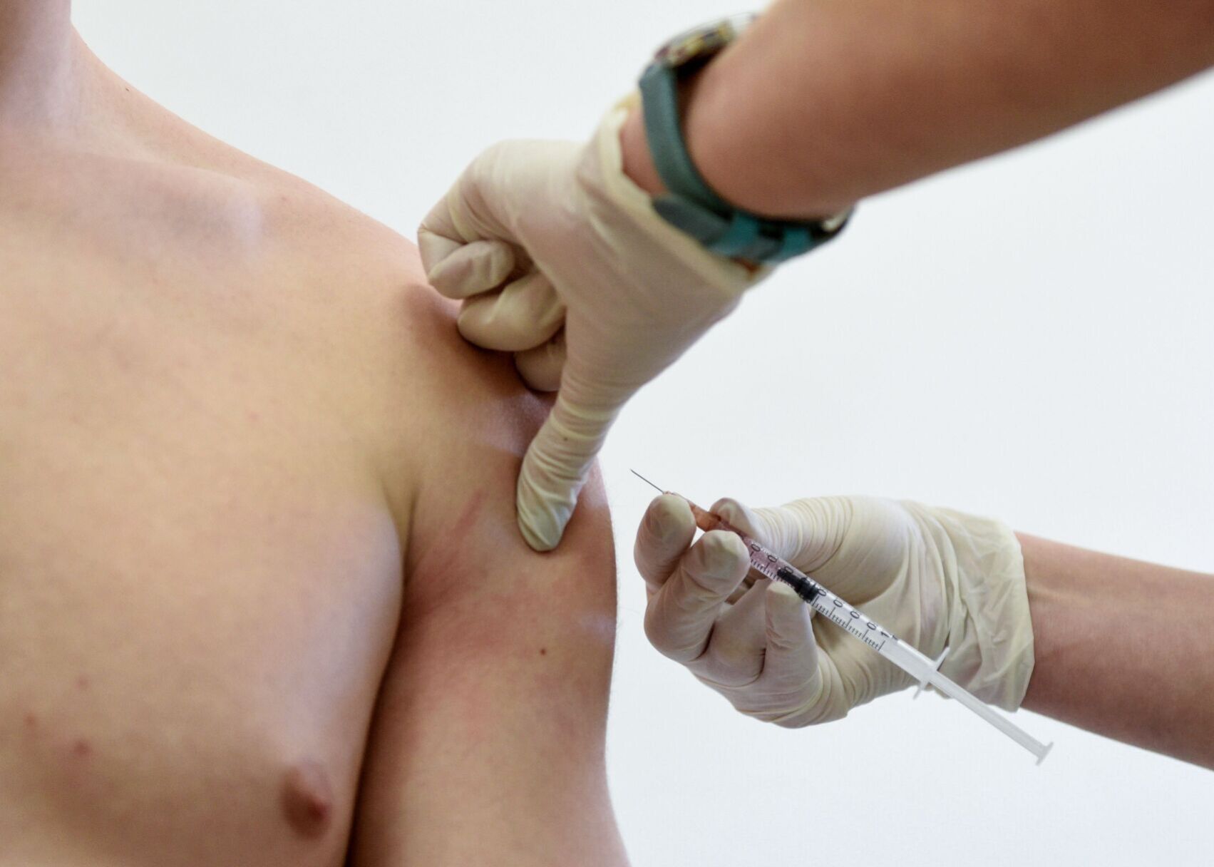 UKRAINE-MEASLES-VACCINES-CHILDREN